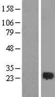 RAB2A / RAB2 Protein - Western validation with an anti-DDK antibody * L: Control HEK293 lysate R: Over-expression lysate