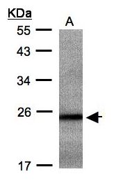RAB2B Antibody - Sample (30 ug whole cell lysate). A: Hep G2 . 12% SDS PAGE. RAB2B antibody diluted at 1:500
