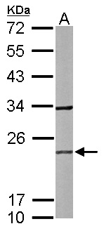 RAB2B Antibody - Sample (50 ug of whole cell lysate). A: mouse brain. 12% SDS PAGE. RAB2B antibody diluted at 1:1000.