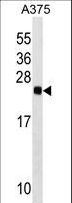 RAB2B Antibody - RAB2B Antibody western blot of A375 cell line lysates (35 ug/lane). The RAB2B antibody detected the RAB2B protein (arrow).