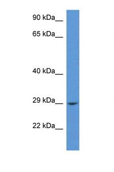 RAB2B Antibody - RAB2B antibody Western blot of 1 Cell lysate. Antibody concentration 1 ug/ml.  This image was taken for the unconjugated form of this product. Other forms have not been tested.