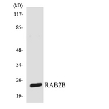 RAB2B Antibody - Western blot analysis of the lysates from 293 cells using RAB2B antibody.