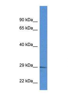 RAB2B Antibody - RAB2B antibody Western blot of U937 Cell lysate. Antibody concentration 1 ug/ml.  This image was taken for the unconjugated form of this product. Other forms have not been tested.