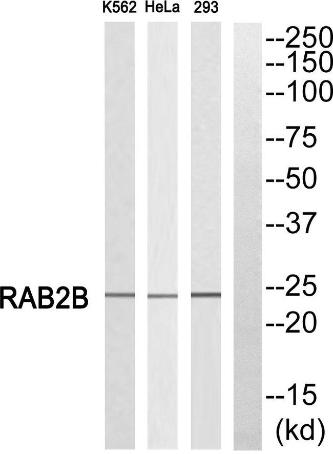 RAB2B Antibody - Western blot analysis of extracts from K562 cells, HeLa cells and 293 cells, using RAB2B antibody.