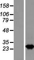 RAB2B Protein - Western validation with an anti-DDK antibody * L: Control HEK293 lysate R: Over-expression lysate