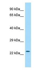 RAB30 Antibody - RAB30 antibody Western Blot of Jurkat.  This image was taken for the unconjugated form of this product. Other forms have not been tested.