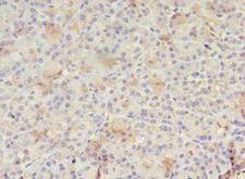 RAB30 Antibody - Immunohistochemistry of paraffin-embedded human pancreas tissue using antibody at 1:100 dilution.  This image was taken for the unconjugated form of this product. Other forms have not been tested.