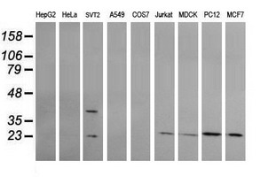 RAB30 Antibody - Western blot of extracts (35ug) from 9 different cell lines by using anti-RAB30 monoclonal antibody (HepG2: human; HeLa: human; SVT2: mouse; A549: human; COS7: monkey; Jurkat: human; MDCK: canine; PC12: rat; MCF7: human).