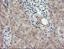 RAB30 Antibody - IHC of paraffin-embedded Human liver tissue using anti-RAB30 mouse monoclonal antibody. (Heat-induced epitope retrieval by 10mM citric buffer, pH6.0, 120°C for 3min).