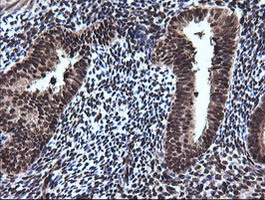 RAB30 Antibody - IHC of paraffin-embedded Human endometrium tissue using anti-RAB30 mouse monoclonal antibody.