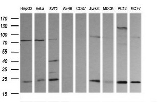 RAB30 Antibody - Western blot of extracts (35 ug) from 9 different cell lines by using anti-RAB30 monoclonal antibody (HepG2: human; HeLa: human; SVT2: mouse; A549: human; COS7: monkey; Jurkat: human; MDCK: canine; PC12: rat; MCF7: human).