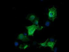 RAB30 Antibody - Anti-RAB30 mouse monoclonal antibody immunofluorescent staining of COS7 cells transiently transfected by pCMV6-ENTRY RAB30.