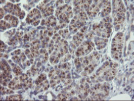 RAB30 Antibody - IHC of paraffin-embedded Human pancreas tissue using anti-RAB30 mouse monoclonal antibody.