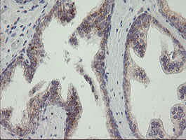 RAB30 Antibody - IHC of paraffin-embedded Human prostate tissue using anti-RAB30 mouse monoclonal antibody.