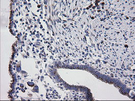 RAB30 Antibody - IHC of paraffin-embedded Human endometrium tissue using anti-RAB30 mouse monoclonal antibody. (Heat-induced epitope retrieval by 10mM citric buffer, pH6.0, 120°C for 3min).
