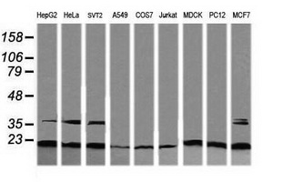 RAB30 Antibody - Western blot of extracts (35ug) from 9 different cell lines by using anti-RAB30 monoclonal antibody (HepG2: human; HeLa: human; SVT2: mouse; A549: human; COS7: monkey; Jurkat: human; MDCK: canine; PC12: rat; MCF7: human).