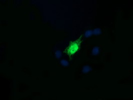 RAB30 Antibody - Anti-RAB30 mouse monoclonal antibody immunofluorescent staining of COS7 cells transiently transfected by pCMV6-ENTRY RAB30.
