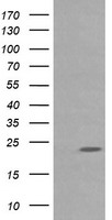 RAB30 Antibody - HEK293T cells were transfected with the pCMV6-ENTRY control (Left lane) or pCMV6-ENTRY RAB30 (Right lane) cDNA for 48 hrs and lysed. Equivalent amounts of cell lysates (5 ug per lane) were separated by SDS-PAGE and immunoblotted with anti-RAB30.