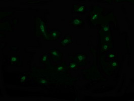 RAB30 Antibody - Immunofluorescent staining of HeLa cells using anti-RAB30 mouse monoclonal antibody.