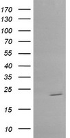 RAB30 Antibody - HEK293T cells were transfected with the pCMV6-ENTRY control (Left lane) or pCMV6-ENTRY RAB30 (Right lane) cDNA for 48 hrs and lysed. Equivalent amounts of cell lysates (5 ug per lane) were separated by SDS-PAGE and immunoblotted with anti-RAB30.