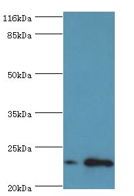 RAB30 Antibody - Western blot. All lanes: RAB30 antibody at 1 ug/ml Lane 1:MCF-7 whole cell lysate. Lane 2: HeLa whole cell lysate. Secondary antibody: Goat polyclonal to rabbit at 1:10000 dilution. Predicted band size: 23 kDa. Observed band size: 23 kDa.  This image was taken for the unconjugated form of this product. Other forms have not been tested.