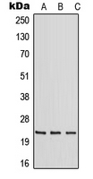 RAB30 Antibody - Western blot analysis of RAB30 expression in HeLa (A); mouse liver (B); rat liver (C) whole cell lysates.