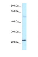 RAB31 Antibody - RAB31 antibody Western blot of Fetal Brain lysate. Antibody concentration 1 ug/ml.  This image was taken for the unconjugated form of this product. Other forms have not been tested.