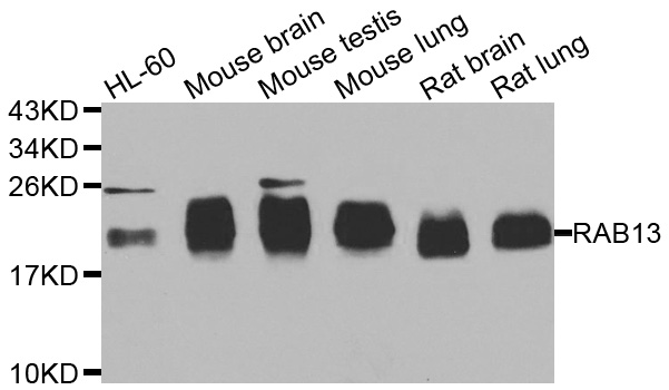 RAB31 Antibody - Western blot analysis of extracts of various cell lines.