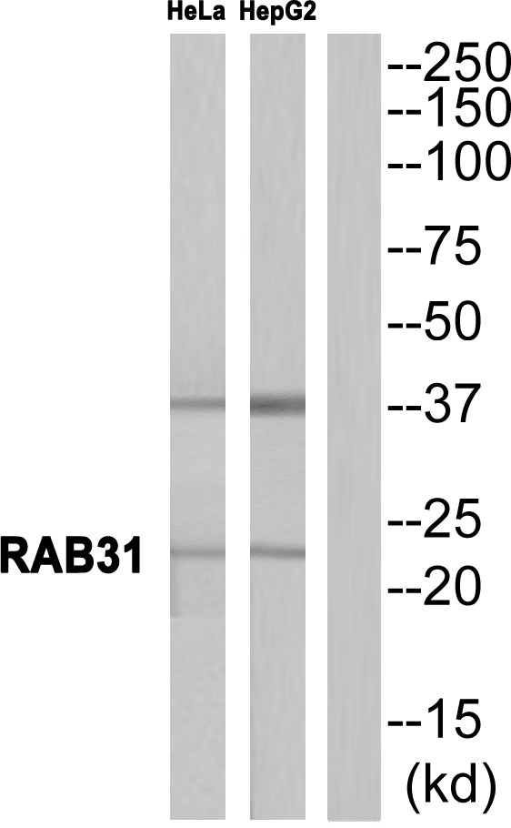 RAB31 Antibody - Western blot of extracts from HeLa cells and HepG2 cells, using RAB31 antibody.