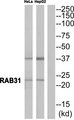 RAB31 Antibody - Western blot of extracts from HeLa cells and HepG2 cells, using RAB31 antibody.