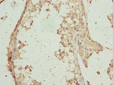 RAB31 Antibody - Immunohistochemistry of paraffin-embedded human testis tissue at dilution 1:100