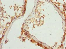 RAB31 Antibody - Immunohistochemistry of paraffin-embedded human testis tissue at dilution 1:100
