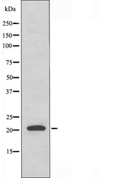 RAB31 Antibody - Western blot analysis of extracts of HeLa cells using RAB31 antibody.