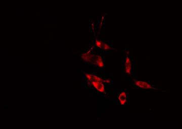 RAB31 Antibody - Staining HeLa cells by IF/ICC. The samples were fixed with PFA and permeabilized in 0.1% Triton X-100, then blocked in 10% serum for 45 min at 25°C. The primary antibody was diluted at 1:200 and incubated with the sample for 1 hour at 37°C. An Alexa Fluor 594 conjugated goat anti-rabbit IgG (H+L) antibody, diluted at 1/600, was used as secondary antibody.