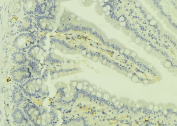 RAB32 Antibody - 1:100 staining mouse colon tissue by IHC-P. The sample was formaldehyde fixed and a heat mediated antigen retrieval step in citrate buffer was performed. The sample was then blocked and incubated with the antibody for 1.5 hours at 22°C. An HRP conjugated goat anti-rabbit antibody was used as the secondary.
