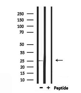 RAB32 Antibody - Western blot analysis of extracts of mouse kidney using RAB32 antibody.