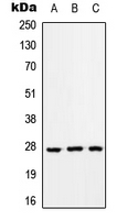 RAB33A Antibody - Western blot analysis of RAB33A expression in HEK293T (A); Raw264.7 (B); PC12 (C) whole cell lysates.