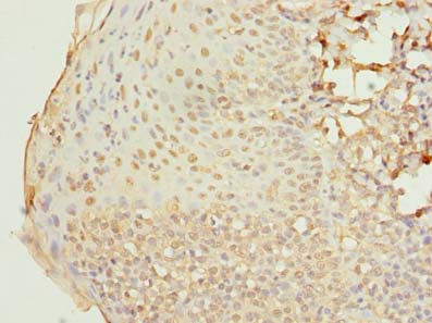 RAB33A Antibody - Immunohistochemistry of paraffin-embedded human tonsil tissue using antibody at dilution of 1:100.