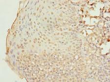 RAB33A Antibody - Immunohistochemistry of paraffin-embedded human tonsil tissue using antibody at dilution of 1:100.