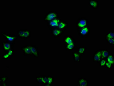 RAB33A Antibody - Immunofluorescence staining of PC3 cells with RAB33A Antibody at 1:166, counter-stained with DAPI. The cells were fixed in 4% formaldehyde, permeabilized using 0.2% Triton X-100 and blocked in 10% normal Goat Serum. The cells were then incubated with the antibody overnight at 4°C. The secondary antibody was Alexa Fluor 488-congugated AffiniPure Goat Anti-Rabbit IgG(H+L).