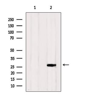 RAB33A Antibody - Western blot analysis of extracts of HepG2 cells using RAB33A antibody. Lane 1 was treated with the blocking peptide.