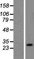 RAB33A Protein - Western validation with an anti-DDK antibody * L: Control HEK293 lysate R: Over-expression lysate