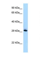 RAB33B Antibody - RAB33B antibody Western blot of Jurkat Cell lysate. Antibody concentration 1 ug/ml.  This image was taken for the unconjugated form of this product. Other forms have not been tested.