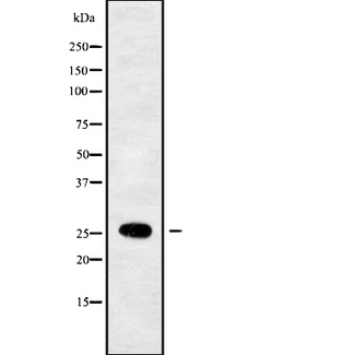RAB33B Antibody - Western blot analysis of RAB33B using LOVO cells whole cells lysates