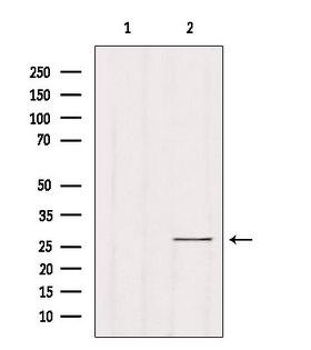 RAB33B Antibody - Western blot analysis of extracts of HeLa cells using RAB33B antibody. Lane 1 was treated with the blocking peptide.