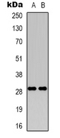 RAB34 Antibody - Western blot analysis of RAB34 expression in HEK293T (A); HeLa (B) whole cell lysates.