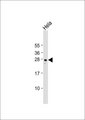 RAB34 Antibody - Anti-RAB34 Antibody at 1:1000 dilution + HeLa whole cell lysate Lysates/proteins at 20 ug per lane. Secondary Goat Anti-Rabbit IgG, (H+L), Peroxidase conjugated at 1:10000 dilution. Predicted band size: 29 kDa. Blocking/Dilution buffer: 5% NFDM/TBST.