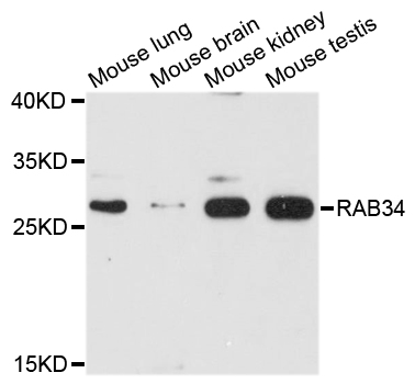RAB34 Antibody - Western blot analysis of extracts of various cell lines, using RAB34 antibody at 1:1000 dilution. The secondary antibody used was an HRP Goat Anti-Rabbit IgG (H+L) at 1:10000 dilution. Lysates were loaded 25ug per lane and 3% nonfat dry milk in TBST was used for blocking. An ECL Kit was used for detection and the exposure time was 90s.