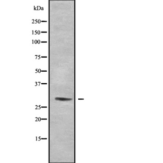 RAB34 Antibody - Western blot analysis of Rab 34 using HepG2 whole cells lysates