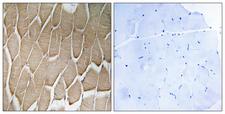 RAB34 Antibody - Peptide - + Immunohistochemistry analysis of paraffin-embedded human skeletal muscle tissue using RAB34 antibody.